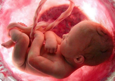 Fibroids and Genetics