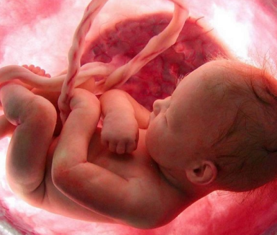 Fibroids and Genetics