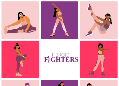 Exercise and fibroids