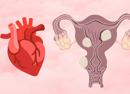 New study on fibroids and heart dieasee