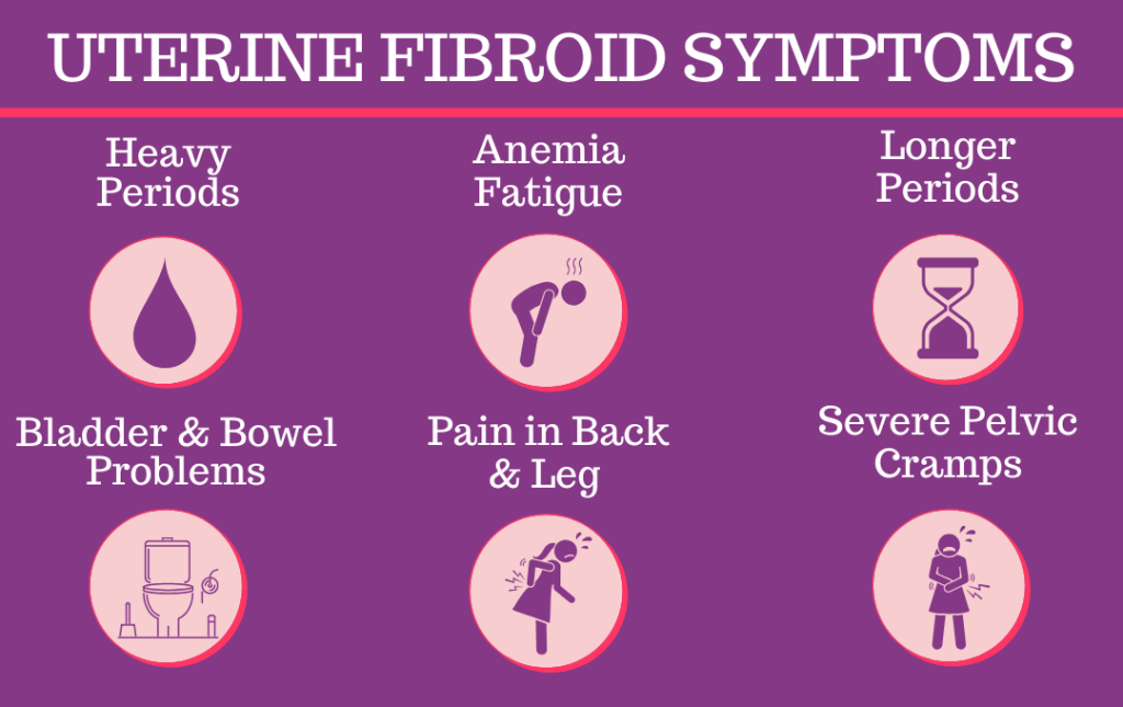 Fibroid symptoms UterineFibroidSymptoms
